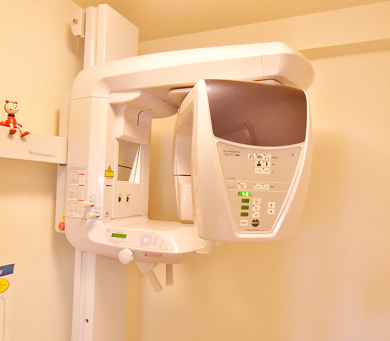 画像：デジタルレントゲン