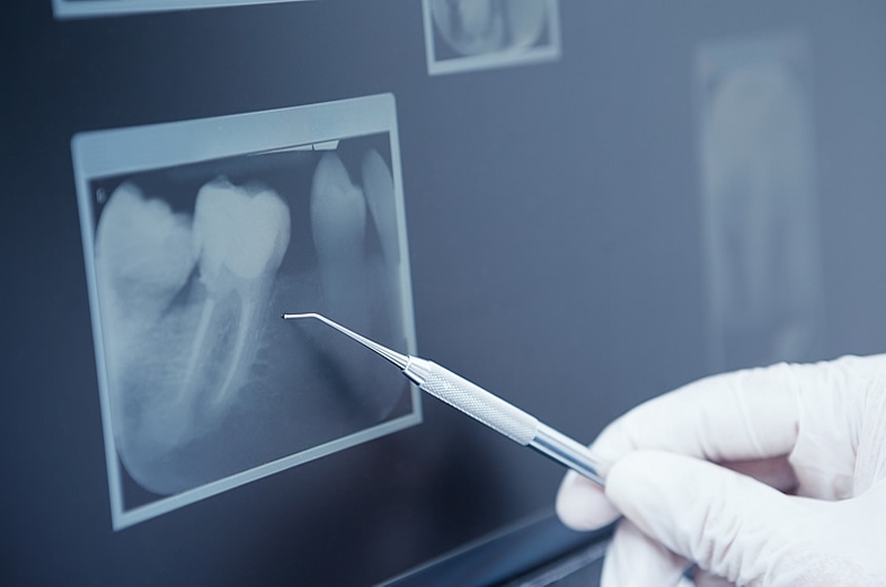 画像：予約から治療までの流れ3