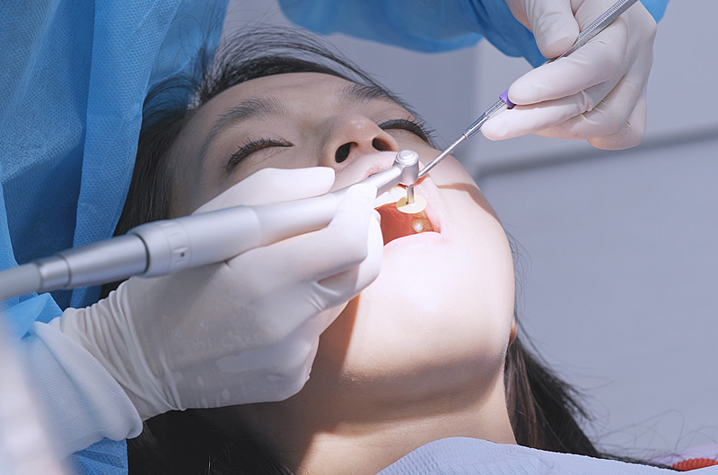 画像：予防歯科