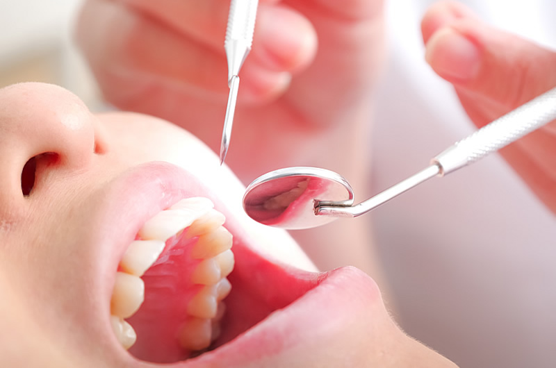 画像：プチホワイトニングのお口の検査